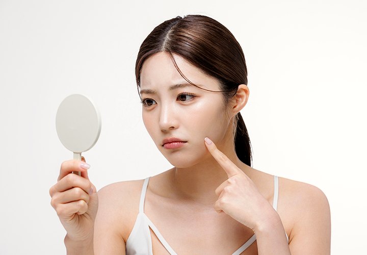 기미·흑자